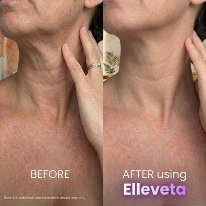 Elleveta™ Tighten & Lift Neck Cream